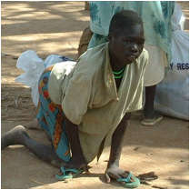 Polio